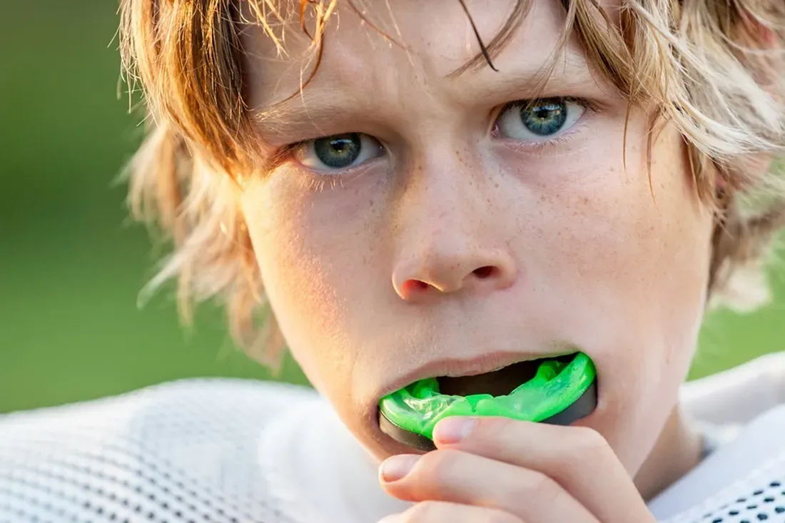 Custom-fitted sports mouthguard made for a young athlete at Agoura Dental Group in Agoura Hills, California